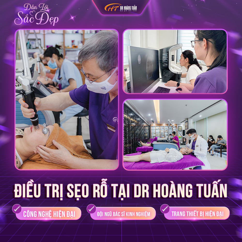 điều trị sẹo rỗ ở đâu tốt nhất